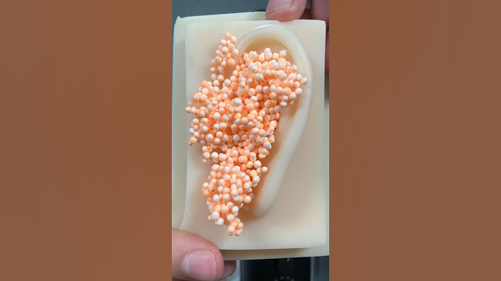 ASMR LIMPIO INFECCIÓN DE TUS OÍDOS #asmr #shorts #viral #humor