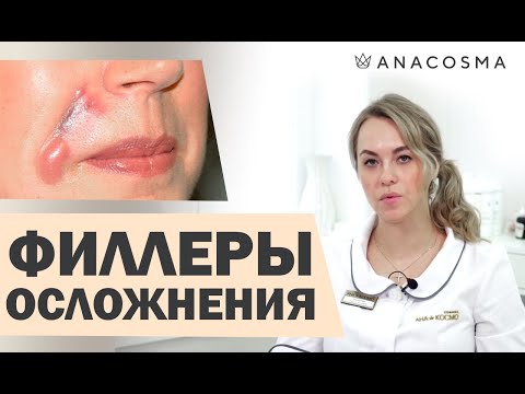 Видео: Белотеро: эффективность, фотографии до и после, побочные эффекты и стоимость