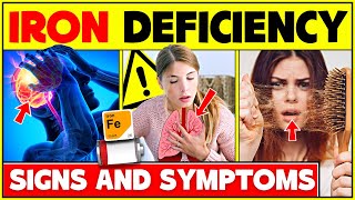 Iron Deficiency Signs And Symptoms - Food Rich In Iron | Low Iron Deficiency Symptoms