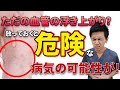 【放置厳禁】血行不良のサイン！細絡の原因と対策をお伝えします『偏頭痛・下肢静脈瘤・月経トラブル』