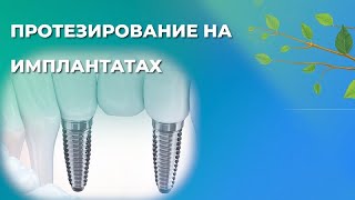 Протезирование на имплантатах