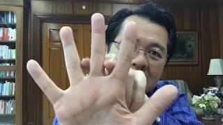 Gout versus Osteo-Arthritis. Iba ang 2 sakit - ni Doc Willie Ong #489