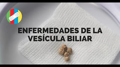 ¿Es difícil hacer caca después de una operación de vesícula biliar?