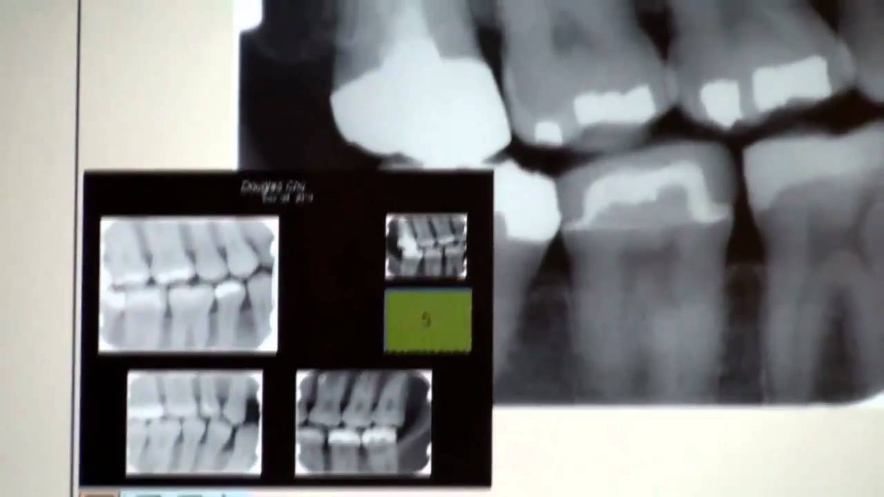 Dentist Broadmoor Richmond Dental Clinic Richmond Centre BC YouTube