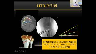 제13회 Precise targeting&Planning in orthopaedic surgery 대표이미지