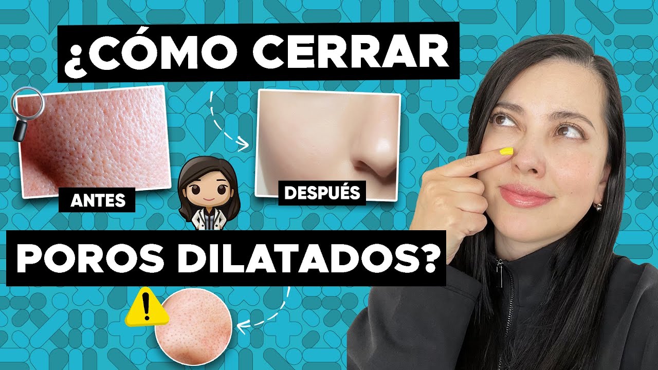 ¡ADIÓS POROS DILATADOS! 👋🏻 Tips de una DERMATÓLOGA 👩🏻‍⚕️🤝🏻👌🏻