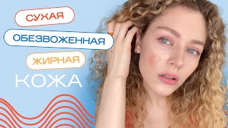 картинка: Сухая, жирная, обезвоженная КОЖА - что делать?