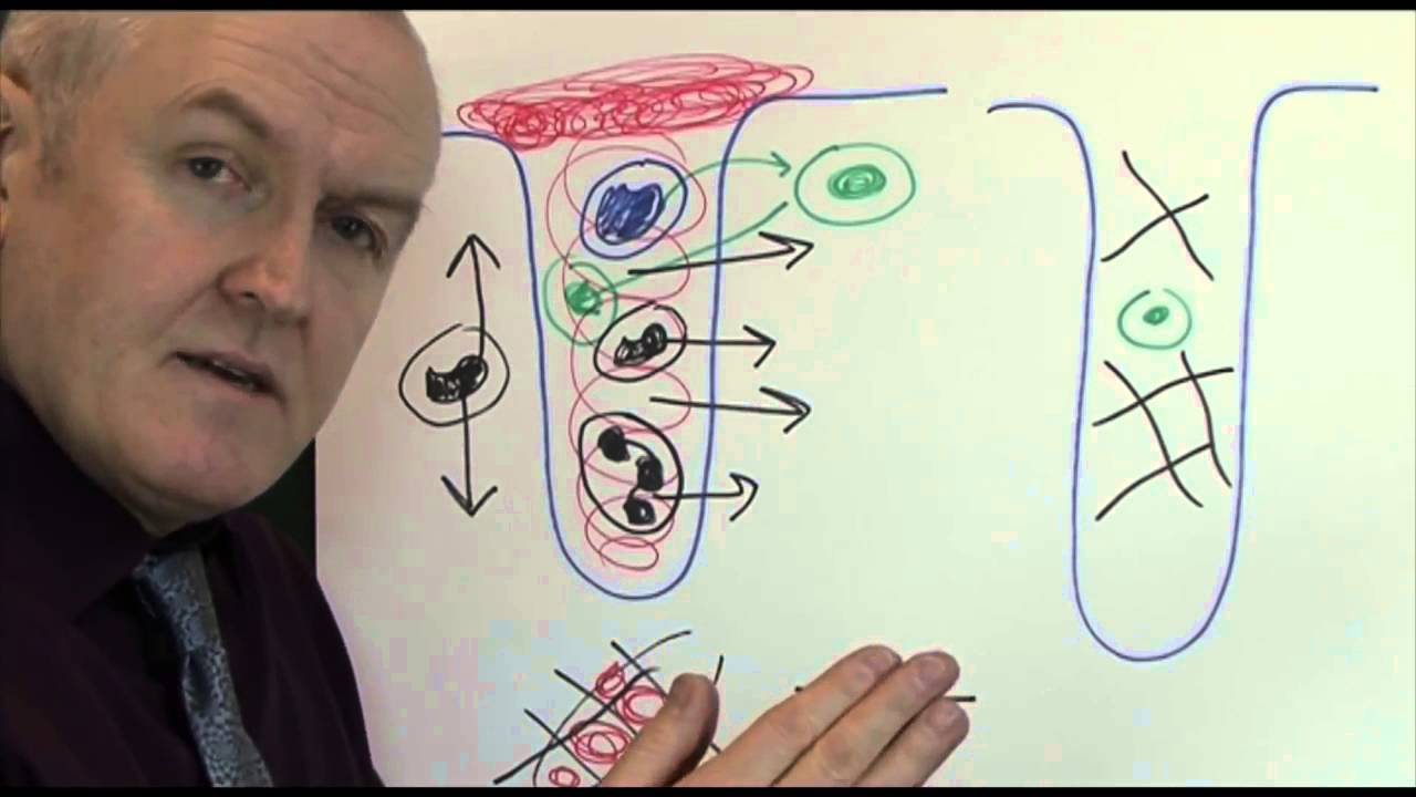 Physiology of wound healing 