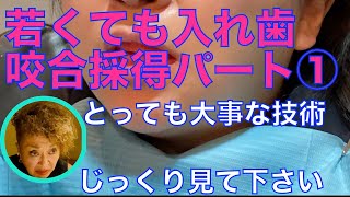 若くても入れ歯、咬合採得①