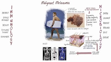 Melanoma Springboard
