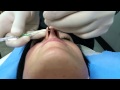 PIERCING SEPTUM RAPIDO,COMO SE HACE UN PIERCING EN EL SEPTUM-SEPTUM PIERCING