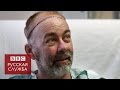 Первая в мире пересадка черепа - BBC Russian