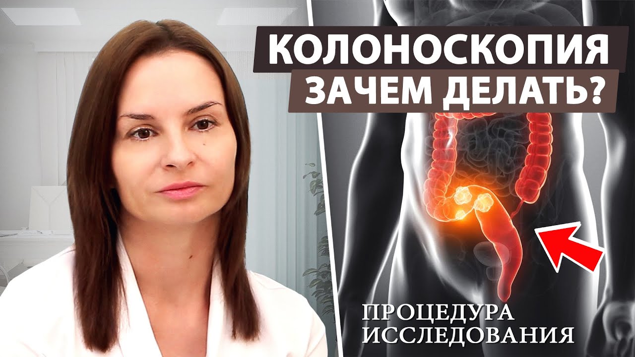 Колоноскопия: зачем удалять полипы и как это делается? - YouTube
