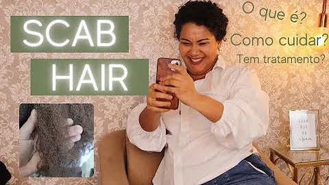 O que fazer para se livrar do Scab hair?