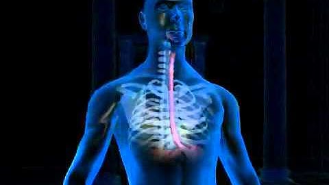 Hepatitis C Infection   3D Medical Animation