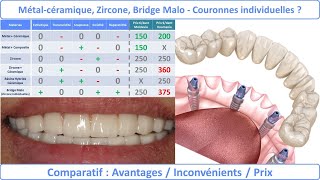 Couronne dentaire et bridge : avantages, types et prix