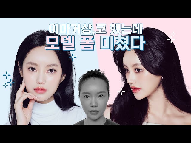 #베리굿성형외과 이마거상/코 했는데 모델 폼 진짜 미쳤다😎😎모델들의 찐 브이로그 후기 👏