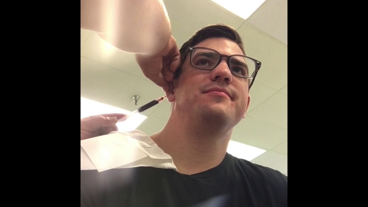 My Cauliflower Ear Drain Montage YouTube
