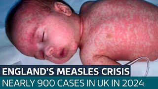 Parents of baby who almost died after contracting measles warn others to get immunised | ITV News
