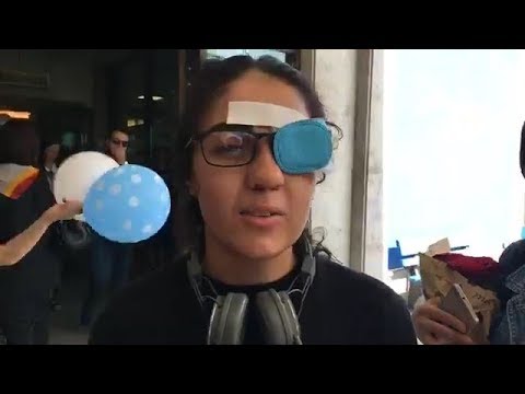 18 წლის მაკომ, რომელმაც აქციის დაშლისას თვალი დაკარგა საავადმყოფო დატოვა