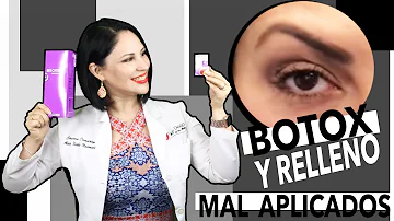 ¿Se puede deshacer el Botox?