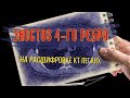 ЭНОСТОЗ ребра (остеосклероз) на КТ легких РАСШИФРОВКЕ (КТ второе мнение)