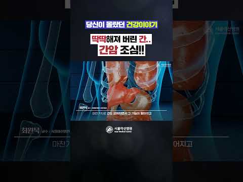 딱딱해져 버린 간.. 간암조심!!#