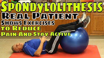 Spondylolithesis- Real Patient Shows Exercises to Reduce Pain & Stay Active