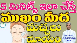ఇలా చేస్తే ముడతలు, మొటిమలు, మచ్చలు మాయంIPimples Removal on Face|Motimalu|Manthena Satyanarayana Raju
