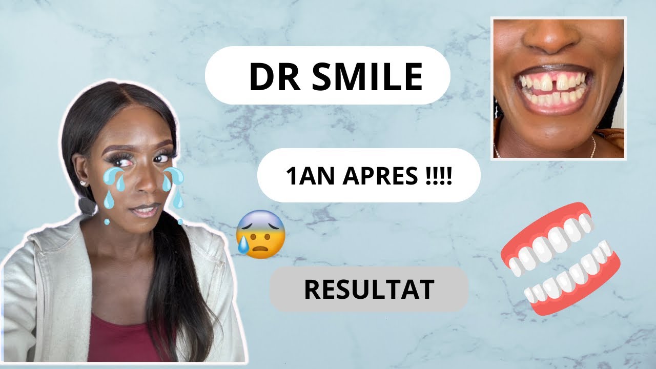 TRAITEMENT DR SMILE 1AN APRÈS: JE RÉPONDS À VOS QUESTIONS 😁