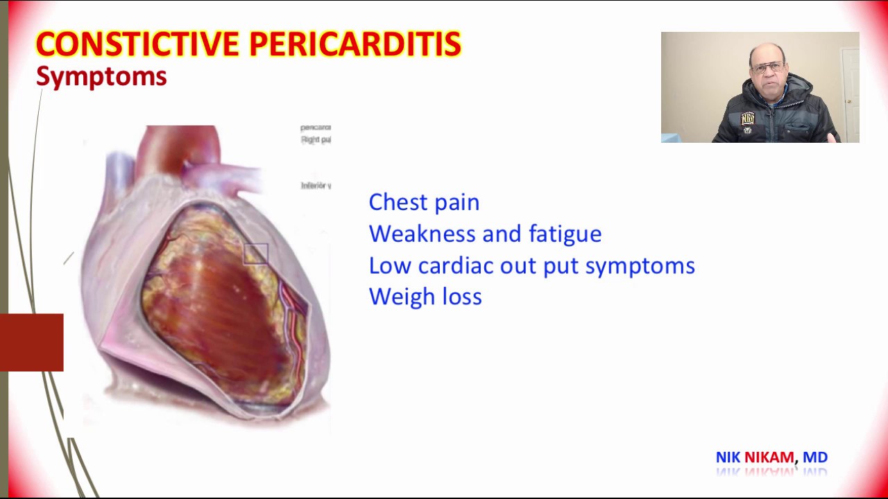 CONSTRICTIVE PERICARDITIS BY NIK NIKAM MD MHA - YouTube