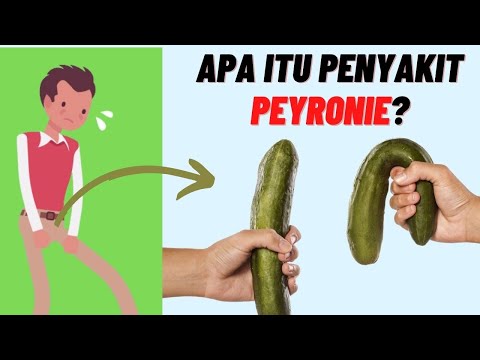 Video: Penyakit Peyronie - Sebab, Gejala, Peringkat Dan Rawatan