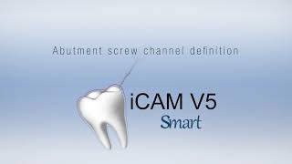 Abutment Screw Channel Definition | iCAM V5 Smart CAD/CAM Dental Software