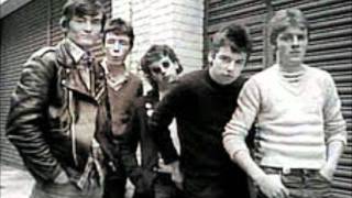 Undertones - valentines treatment
