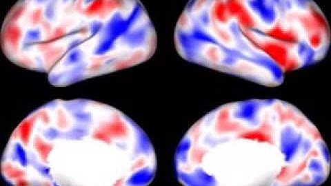 Temporal Non-Local Means Filtering Reveals Real-Time Whole-Brain Cortical Interactions in Resting