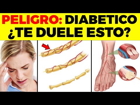 Puede un diabetico comer naranjas