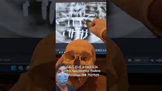 IMPLANTOLOGIA NETWORK PADOVA CHIRURGIA GALILEUS A GRIGLIA DENTI FISSI 2 ORE