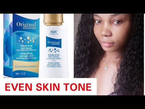 HONEST REVIEW ABOUT FAIR AND WHITE ORIGINAL Glutathione - YouTube HONEST REVIEW ABOUT FAIR AND WHITE ORIGINAL Glutathione - YouTube