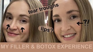 My First Filler & Botox Experience | Elise Hewlett