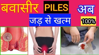 बवासीर जड़ से खत्म मात्र 15 दिन में ? Homoeopathic medicine for piles | piles treatment in homo....