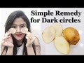 100% Natural and Effective home remedy for dark circles | In Hindi