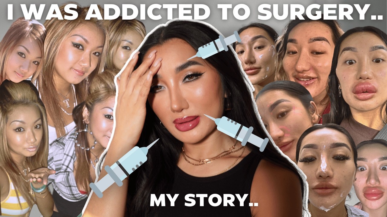 I Did Everything to ‘Fix’ Myself… But It Wasn’t Enough | My Surgery & Filler Journey