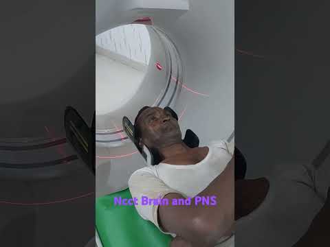 CT scan of Brain and PNs - YouTube