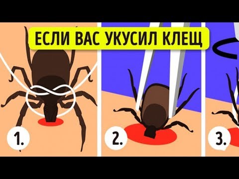 ЧТО ДЕЛАТЬ, ЕСЛИ В ТЕБЯ ВОПЬЕТСЯ ОПАСНЫЙ КЛЕЩ