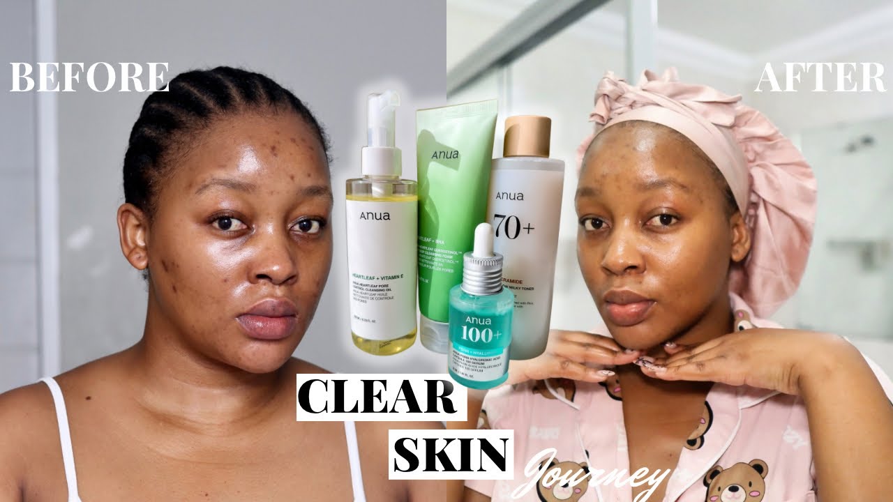 НОЧНОЙ УХОД ЗА КОЖЕЙ | избавляюсь от прыщей и темных пятен с помощью программы Skin Cycling