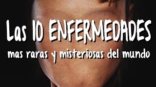 Las 10 ENFERMEDADES MAS MISTERIOSAS y raras del mundo