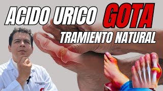ACIDO URICO -GOTA TRATAMIENTO NATURAL dr Javier E moreno