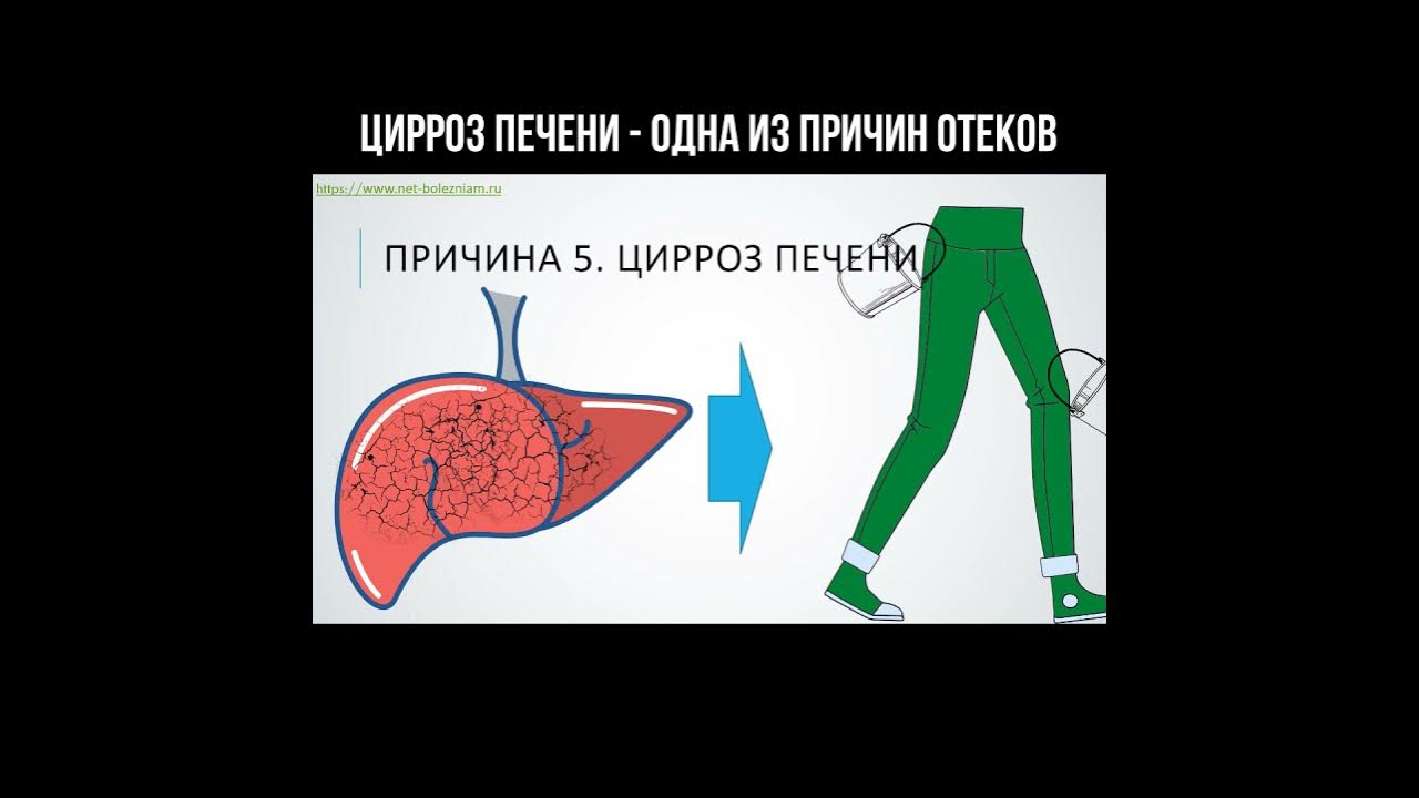 Pin on Health
