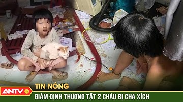Vụ cha xích chân con trong phòng: Giám định thương tật 2 cháu | ANTV