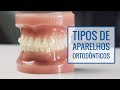 Tipos de Aparelhos Ortodônticos